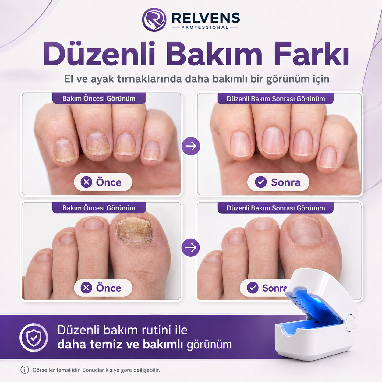 RELVENS Işık Destekli Tırnak Bakım Cihazı